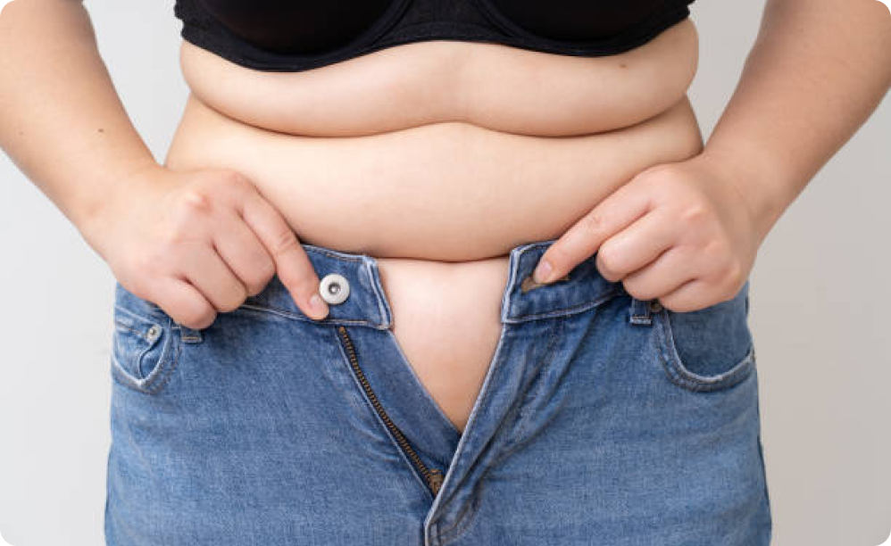 Woman unable to button her jeans due to excess weight